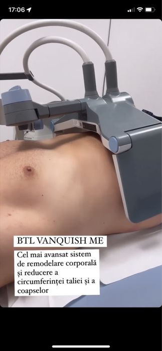 Aparat remodelare corporala Vanquish me