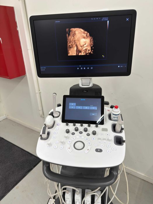 Samsung HS60 экспертный УЗИ аппарат