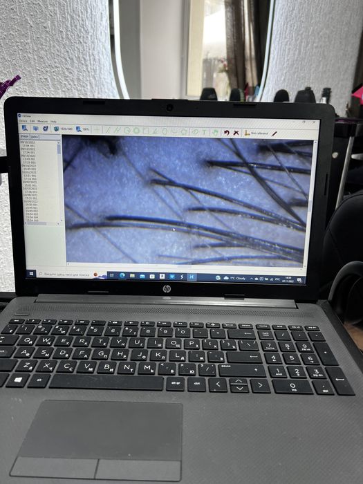 Лечение кожи головы/восстановление волос