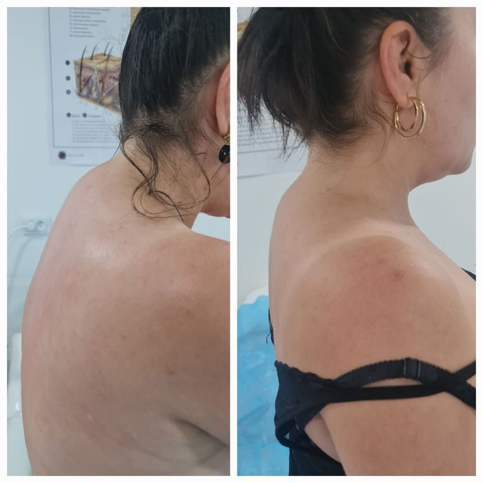 Косметологические услуги (мужчины и женщины) ,фуллфейз ботокс, губы