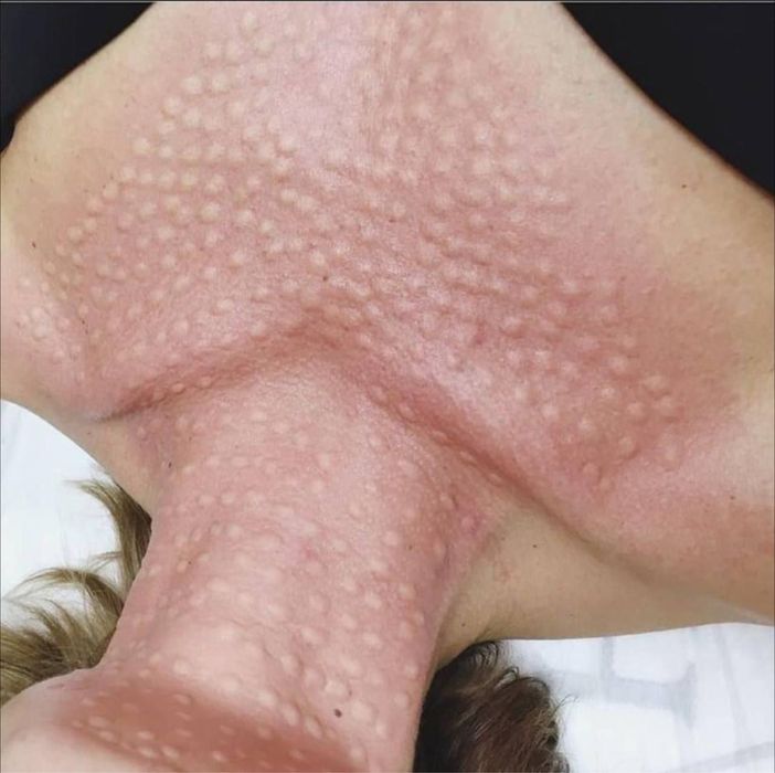 Косметолог шошиламиз кизлажонла декабр ойга  котта скидка