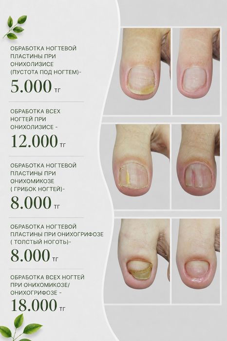 Педикюр, подолог