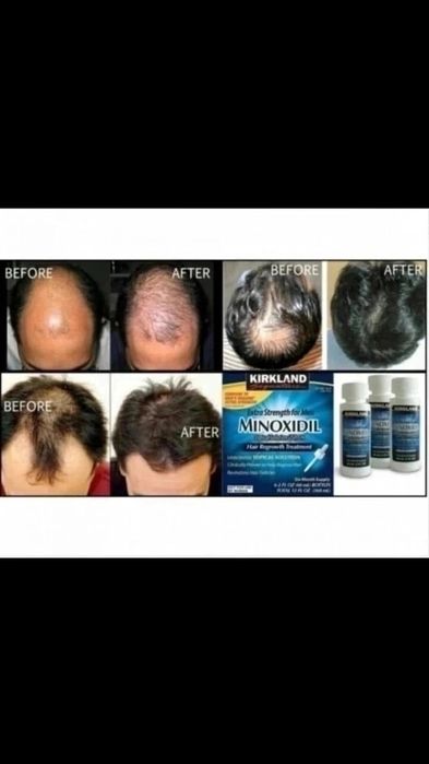 Средство для роста бороды и волос