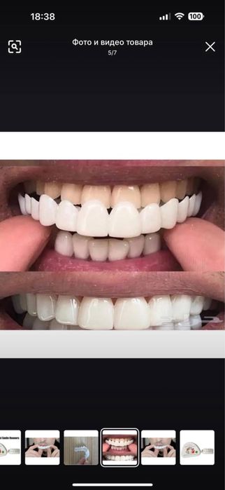 силиконовые виниры для зубов