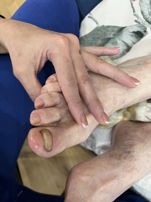 сложный педикюр