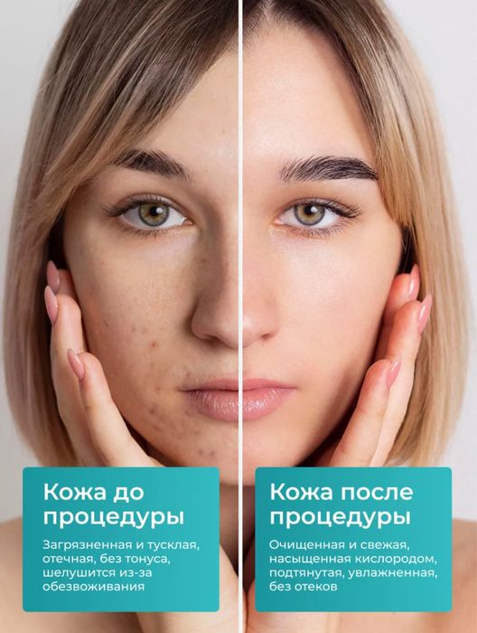 Аппарат для УЗ чистки дома