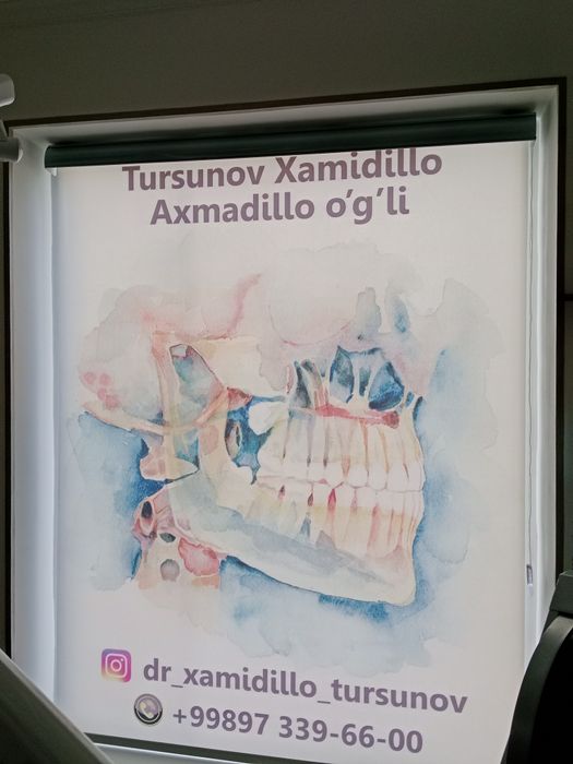 Jalyuzi Foto jalyuzi, dikey jalyuzi, potolochniy karniz