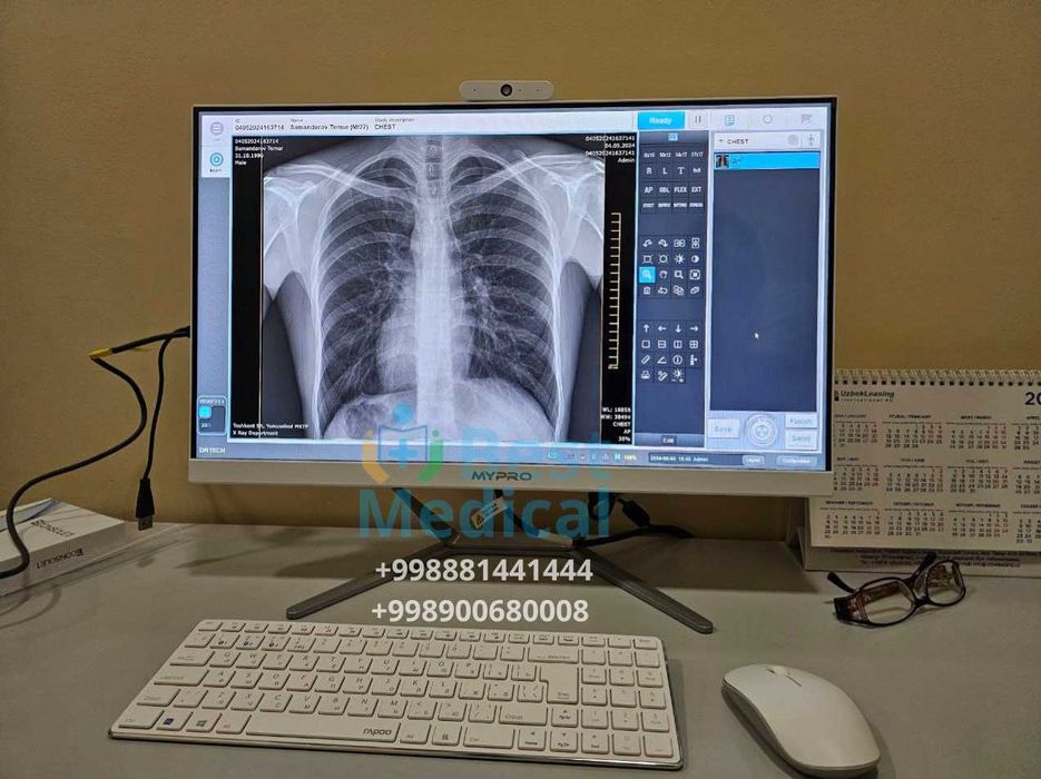 Portativ rentgen x-ray