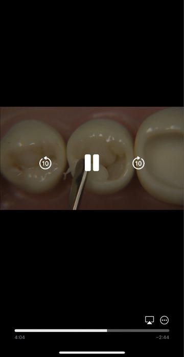 Biomimetic Restorative Dentistry  Volume 1 Pascal Magne Urs Belser