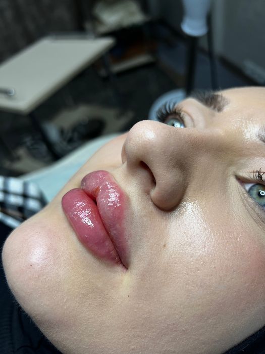 Нужны модели на увеличение губ