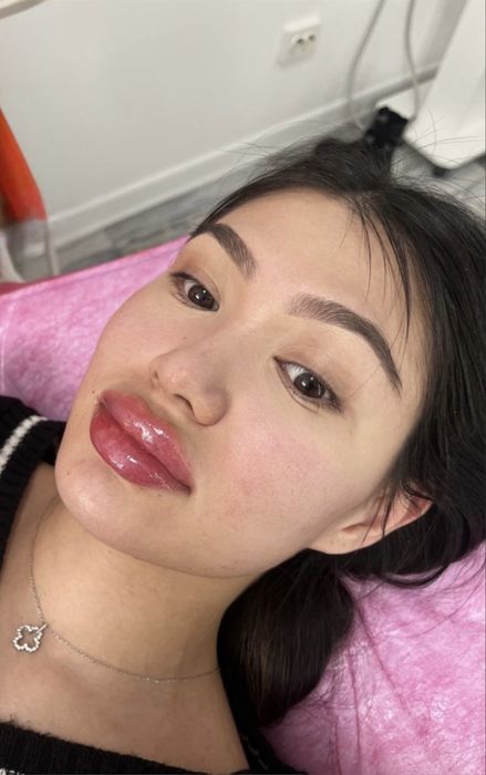 Увеличение губ,мезо,ботокс 30.000