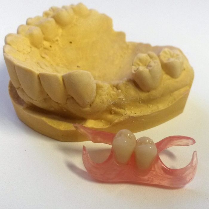 Зубные протезы    с