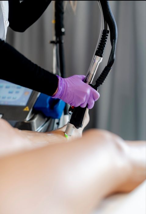 Deka Motus Ax - Laser epilare definitivă Alexandrite