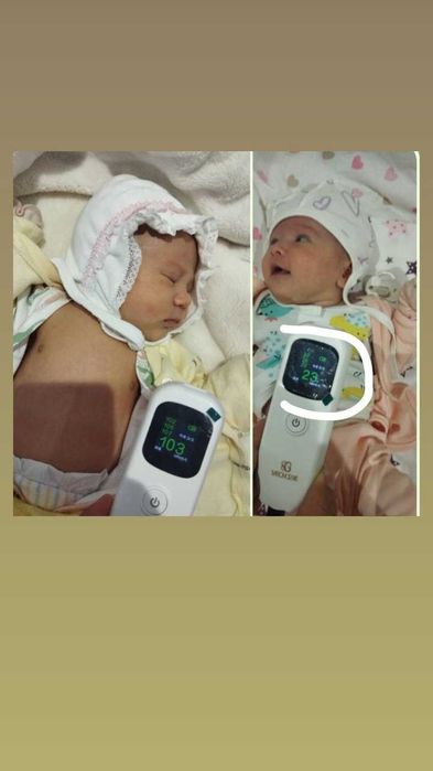 Фотолампа Желтушность у детей.Аренда есть, Sariqlikni davolovchi lampa