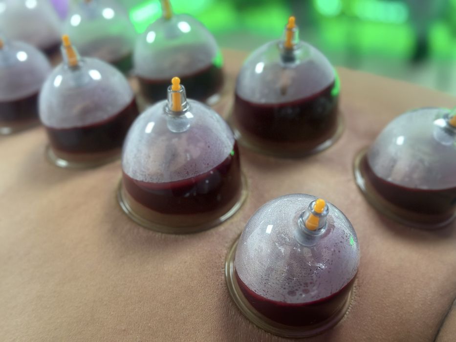 Оздоровительная хиджама