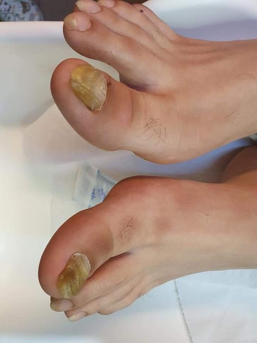 Pedichiura pentru seniori