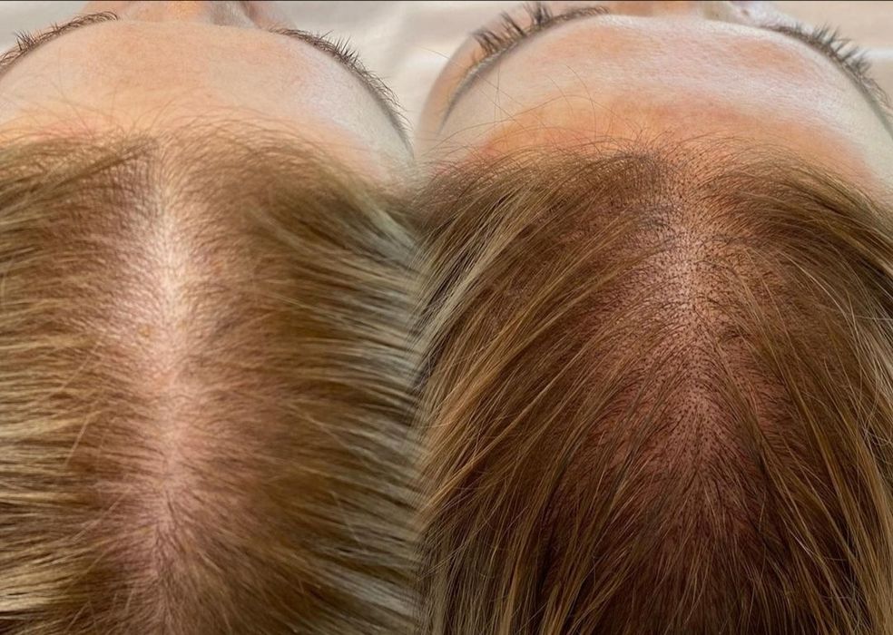 Трихопигментация волос