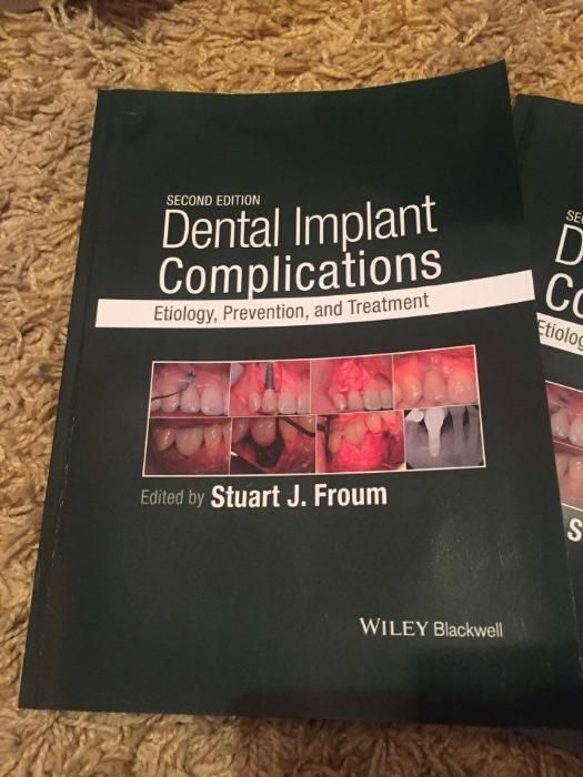 Dental Implant Complications J.Froum,2nd edition 2016