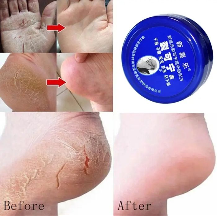 Лечебный китайский крем для ног и рук