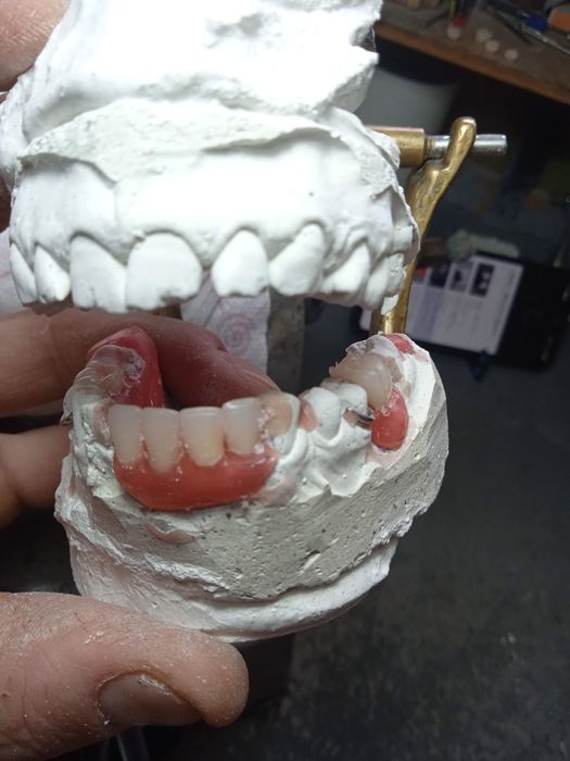 Продам протезы съёмные