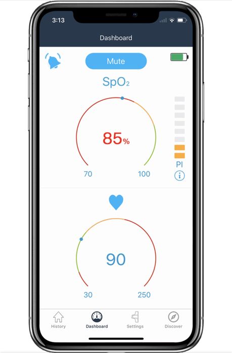 Oxylink™ - Puls Oximetru + WiFi-Remote Linker