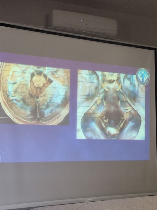 Приём  доктора- остеопата