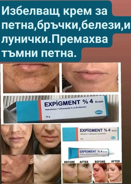 Избелващ Крем за лице