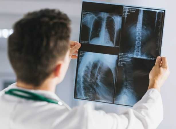 ВТОРО МНЕНИЕ за Компютърна Томография, Рентген, Скенер КТ ЯМР Консулт