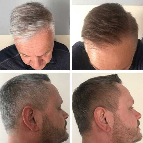 Tratament nat. pt. repigmentarea parului carunt, GR-7 Professional GR7