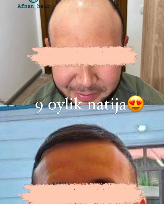 Soch Ekamiz 100% Garantiya