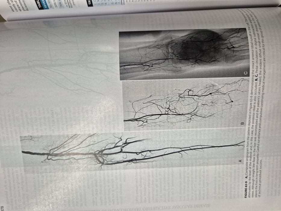 Учебник по Кардиология