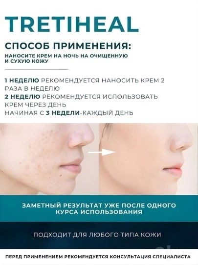Tretinoin 0.025 % Healing Pharma