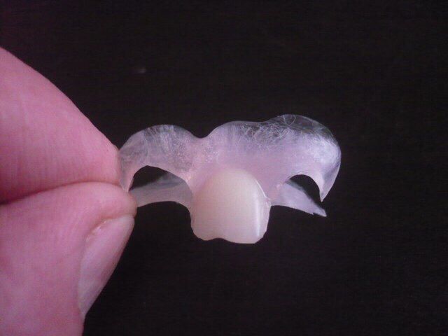 Зубные протезы    с