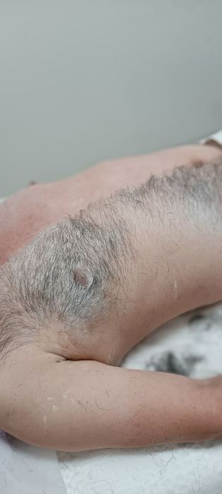 Депиляция мужчинам