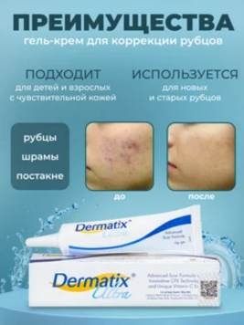 Гель для лечения шрамов