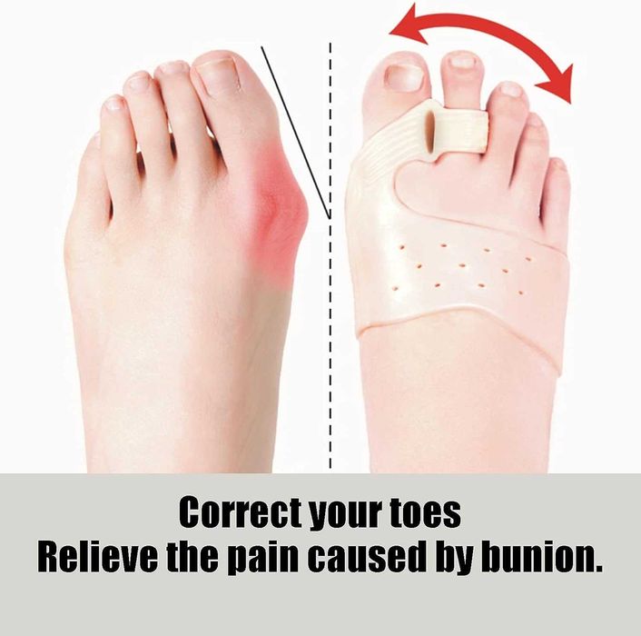 Corector monturi si separator degete de la picior din silicon + magnet