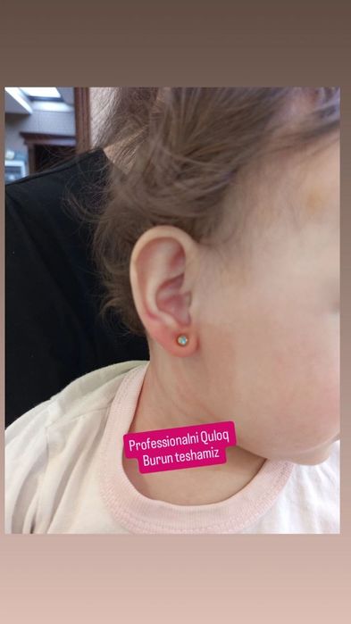 Quloq va Burun teshish xizmati America ziraklarida