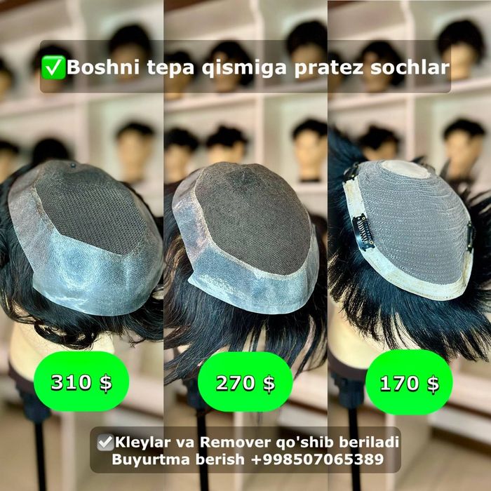 Parik Nakladka | протез соч париклар етказиб бериш