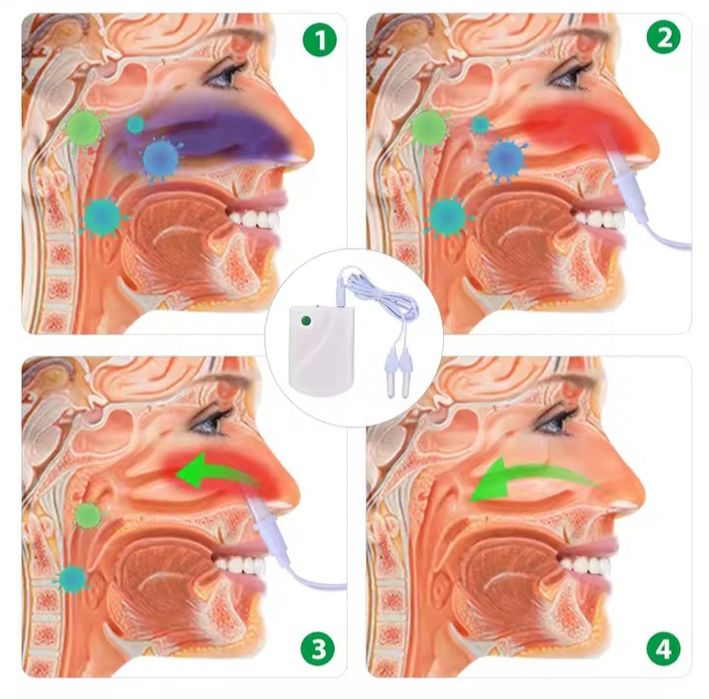 Лазерна терапевтична лампа.Лечение - нос.Бонус-батерия Philips. Bionas