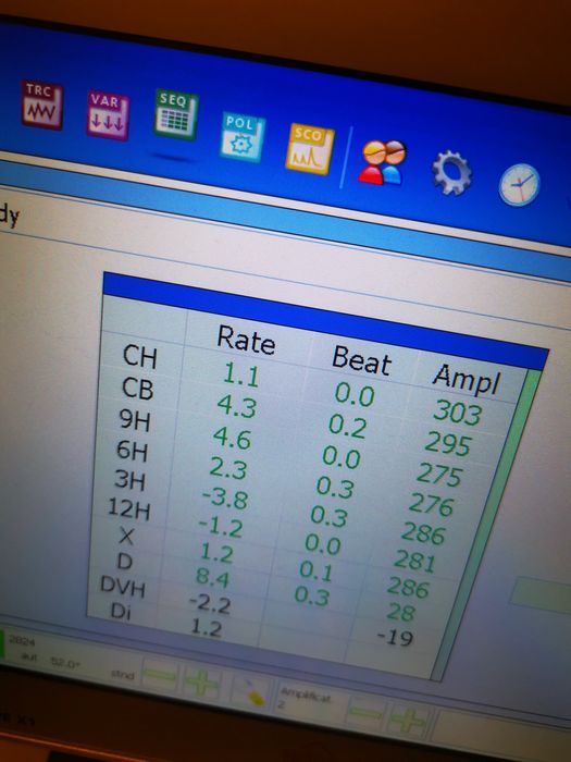 Wittnauer Longines AS5008