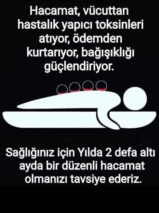 тиббий зулуклар медицинский пиявки