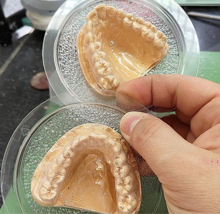 Зубной каппа после брекет