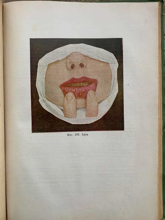 Терапевтична стоматология-Димитър Свраков