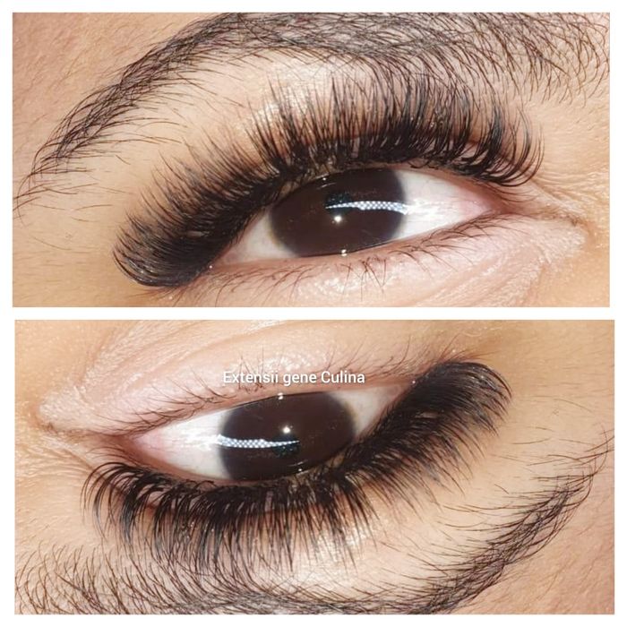 Extensii gene Galați