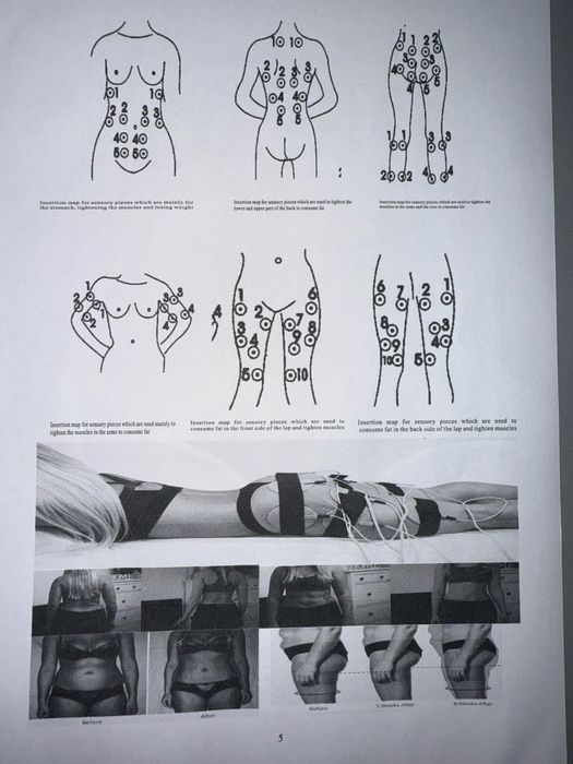 Миостимулятор EMS физиотерапия аппарати