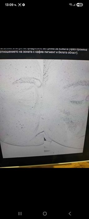 Анализатор на кожата / Skin check