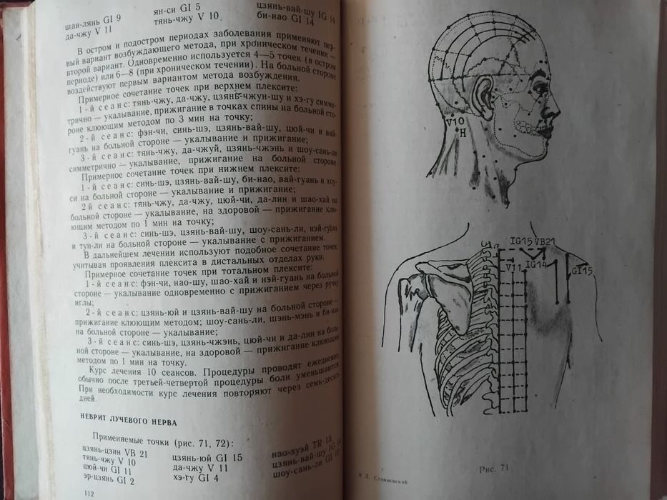 Иглотерапия Редкие  Книги