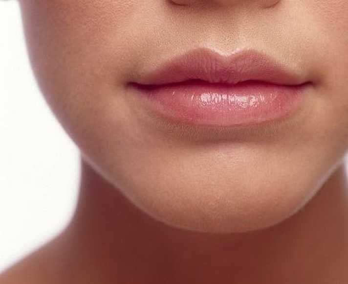 Увеличение губ. Контурная пластика и коррекция губ.