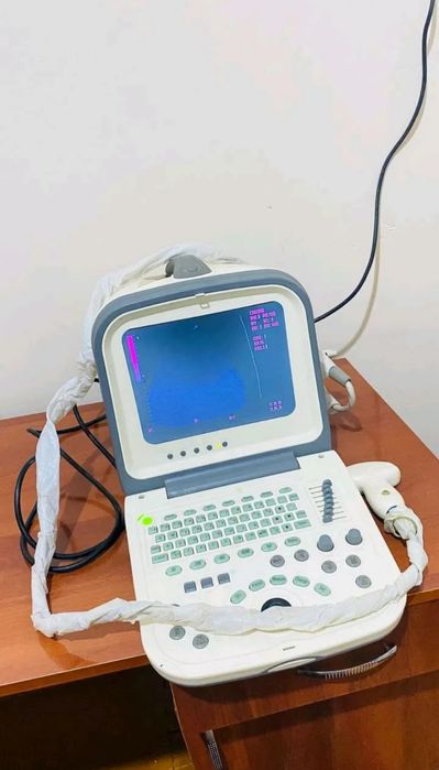 КЛАССНЫЙ УЗИ-аппарат портативный