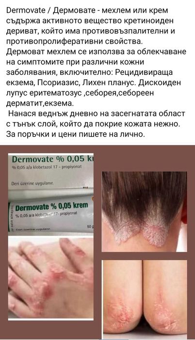 Дермоват крем за Псиориазис